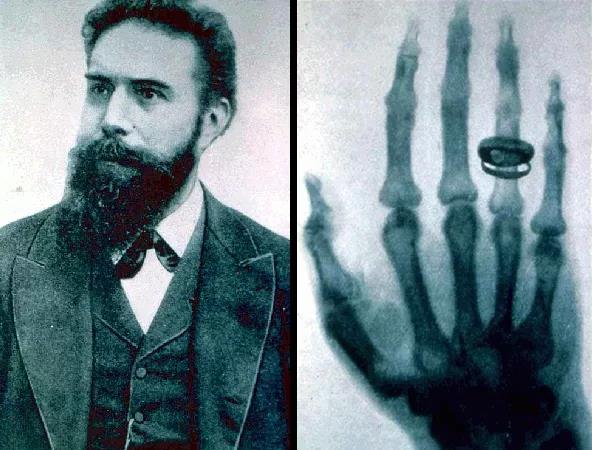 X-ray Roentgen