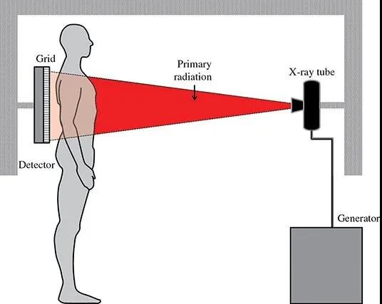 X-ray diagnosis