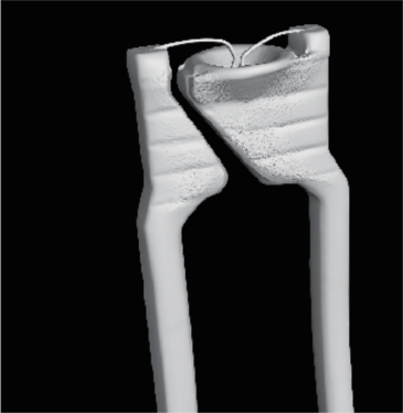 High-Precision Desktop Precise CT Image