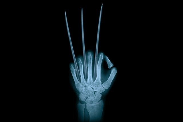 X-rays