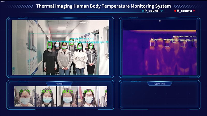 thermal imaging temperature camera